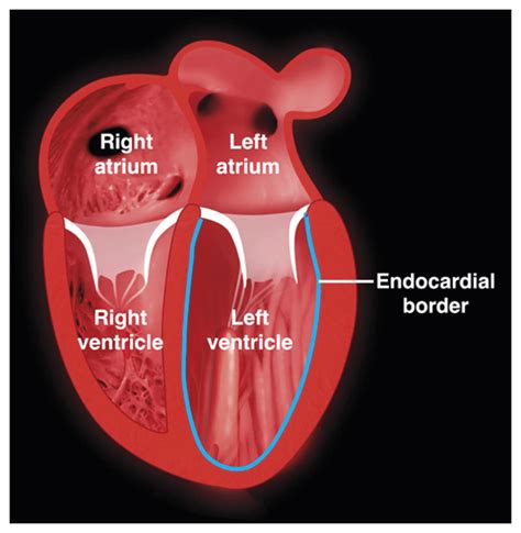 lv function afib|left ventricular function function.